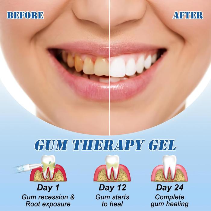 NESLEMY™ Chewing Gum Shield Therapy Gel