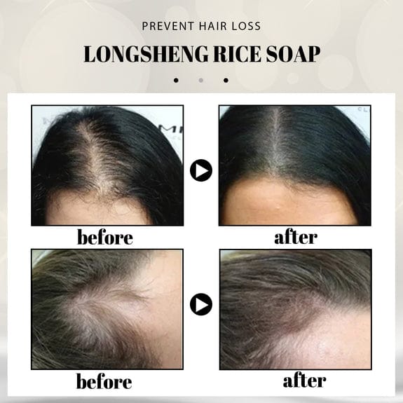OriginPro Anti-Hair Loss Rice Shampoo Bar